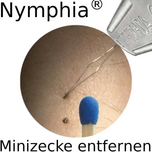 Nymphia Zeckenentferner